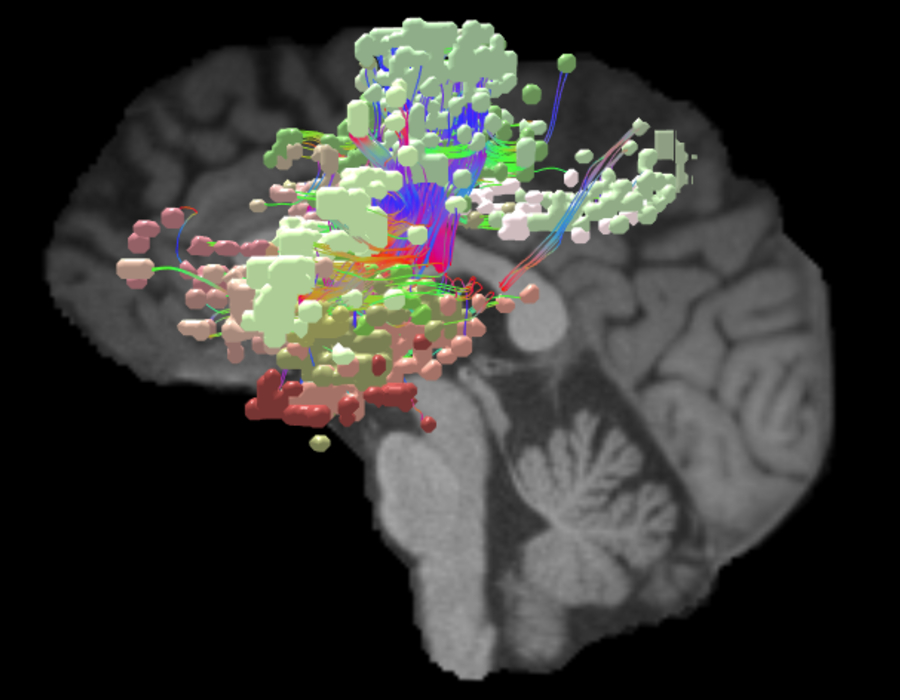 The Salience Network